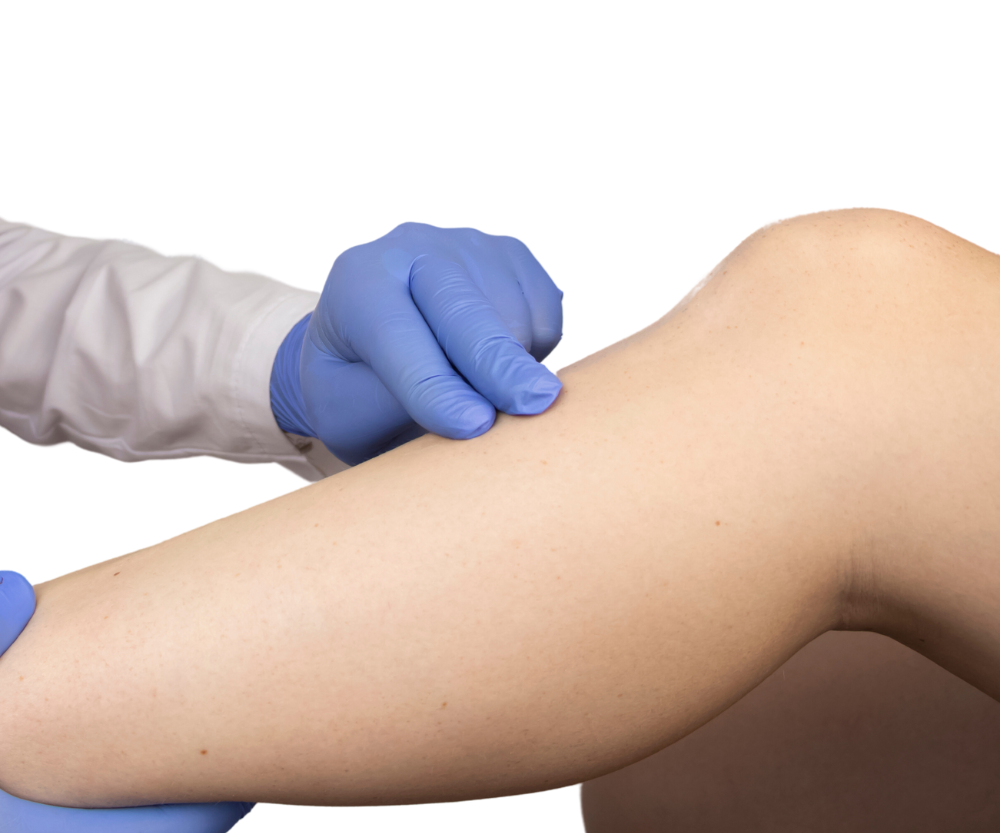 Leg Pain and Numbness